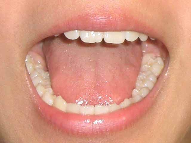 舌下免疫療法・体験談